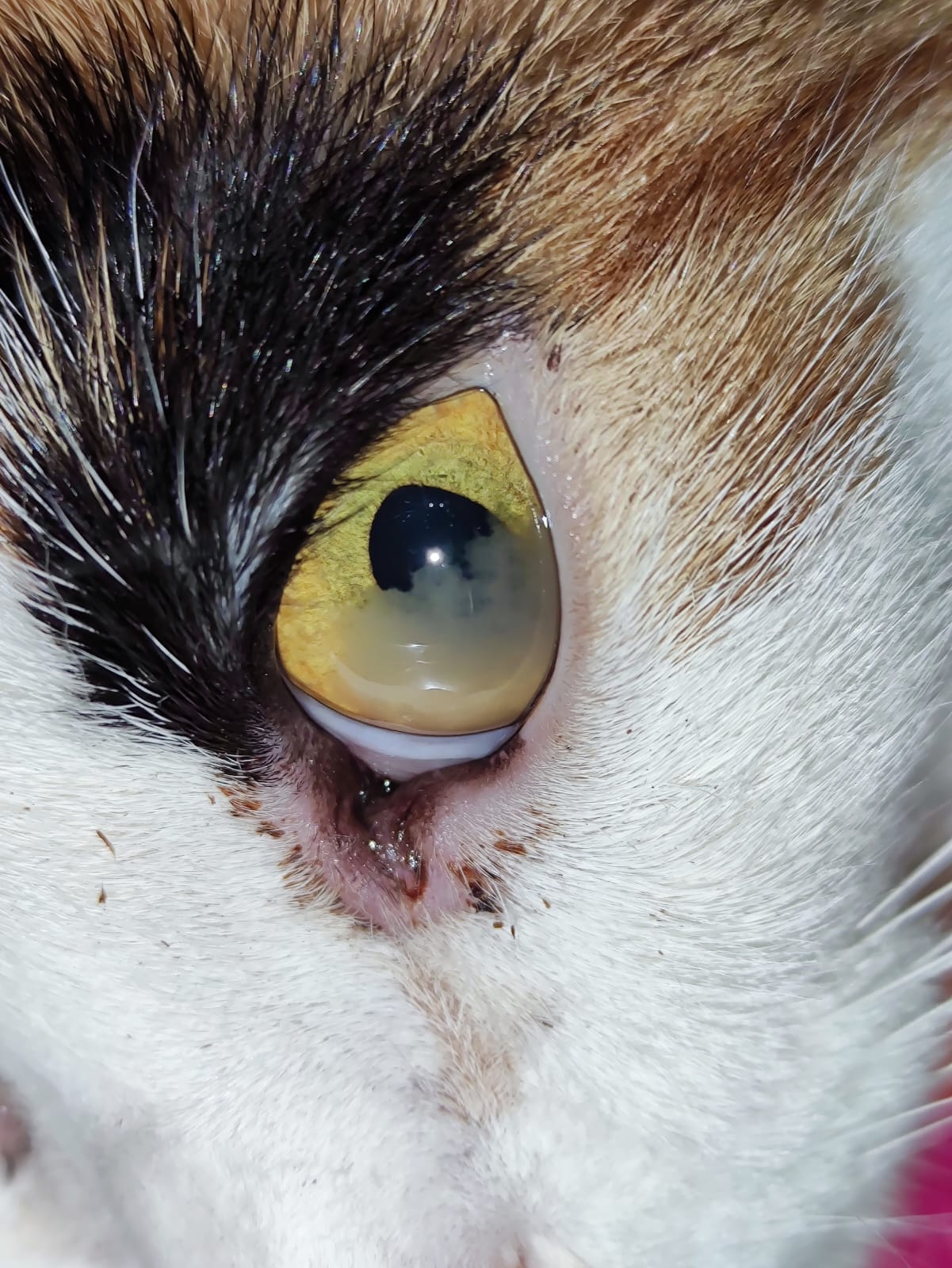 מה הקשר בין עיניים לשתן?